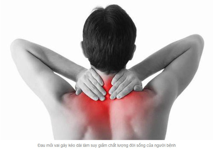 Tiểu Châm Đao – Hỗ trợ điều trị thoái hóa khớp vai hiệu quả