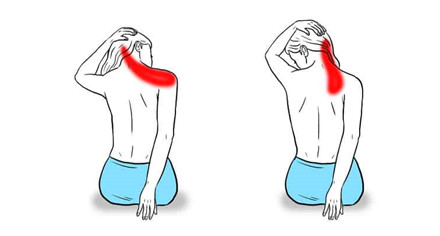 CÁC BÀI TẬP VẬN ĐỘNG ĐIỀU TRỊ VIÊM QUANH KHỚP VAI AN TOÀN HIỆU QUẢ TẠI NHÀ