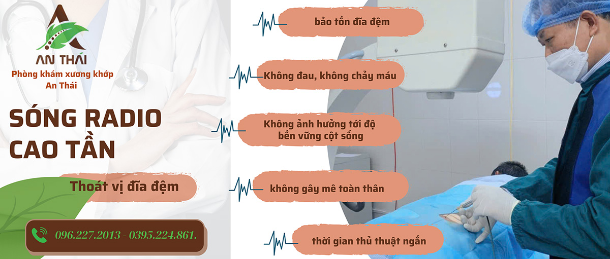 Phương pháp điều trị Sóng radio cao tần