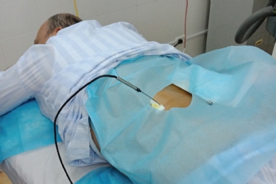 Điện châm sóng âm nội nhiệt